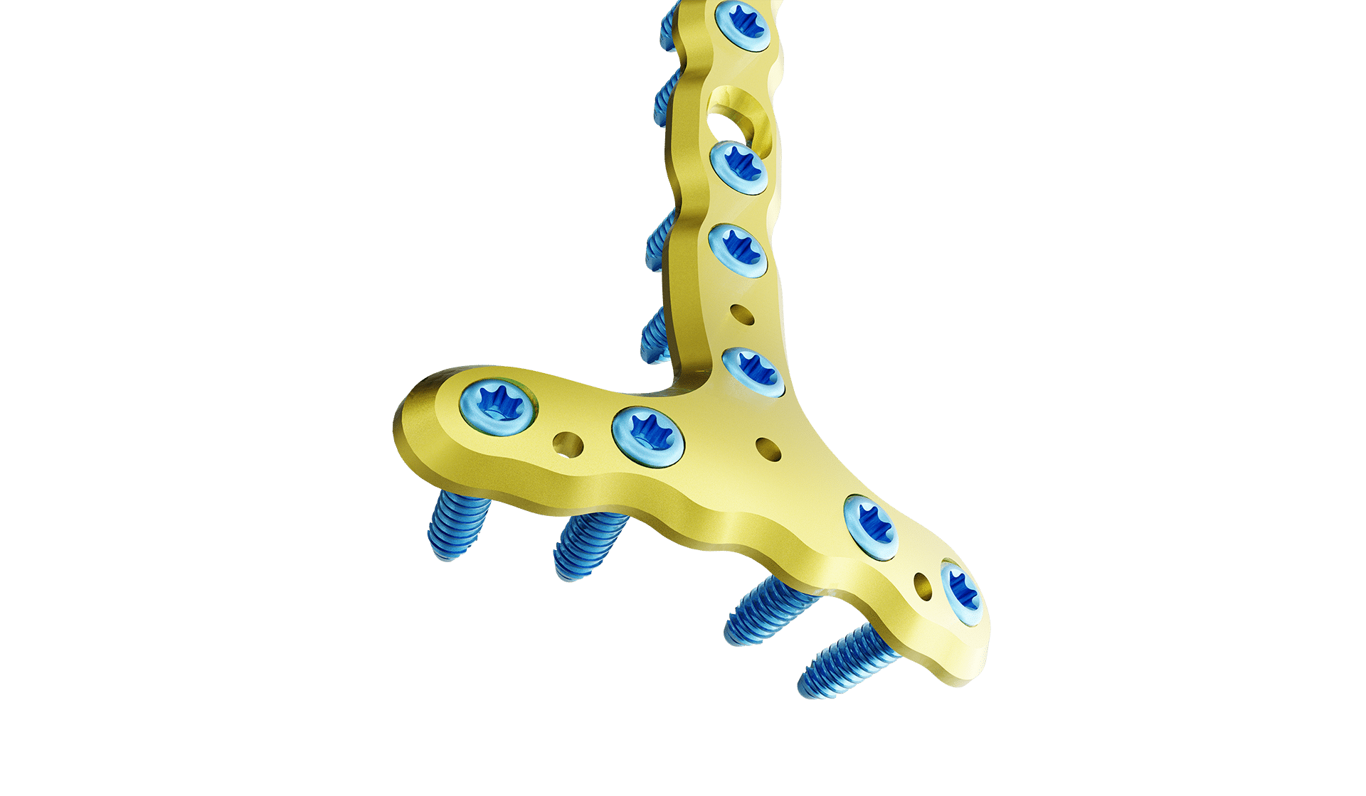 Distal Tibia Anterior Plak