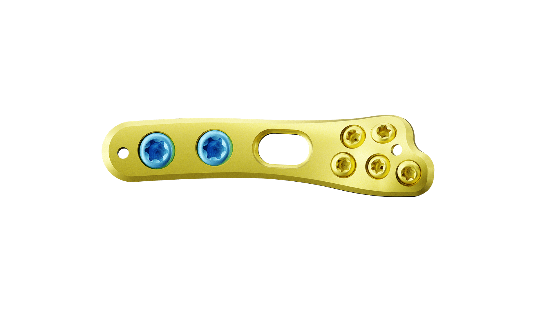 Distal Ulna Anatomik Plak