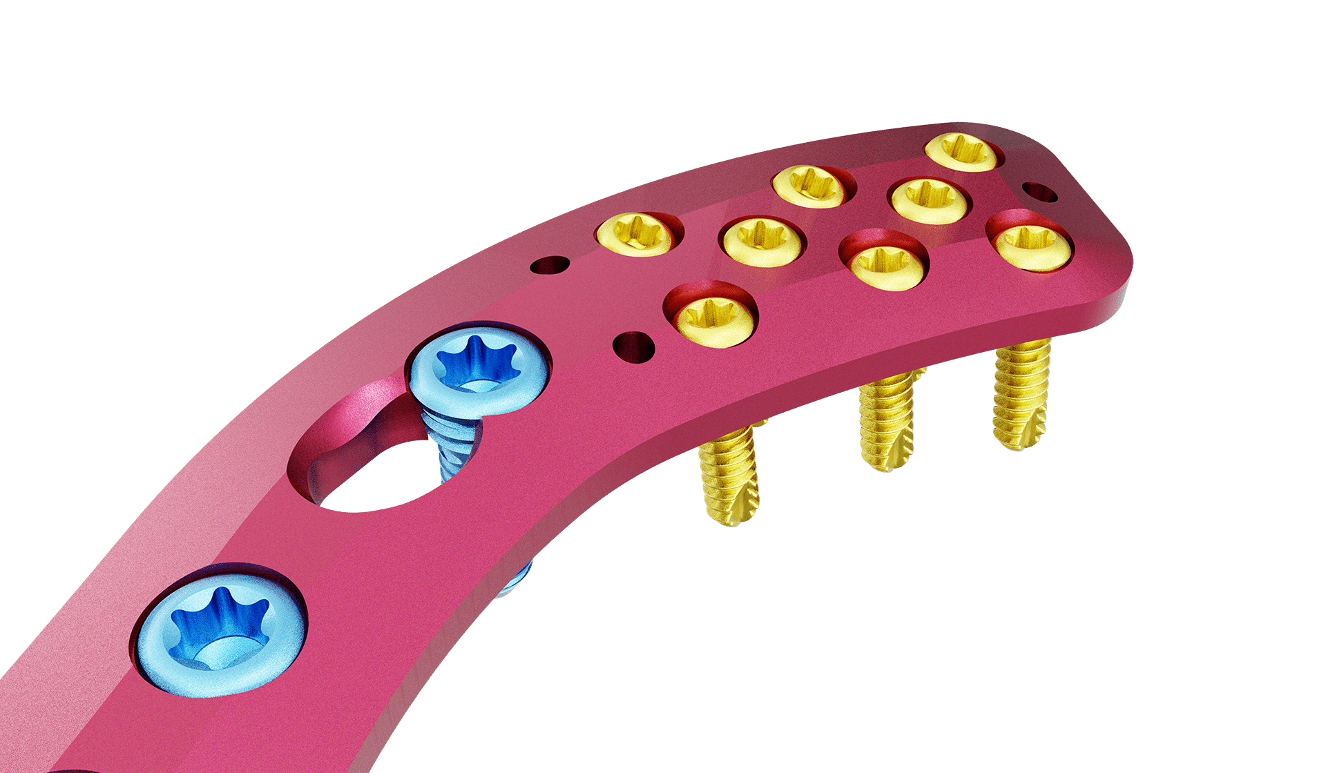 Superior Distal Clavicle Anatomic Plate