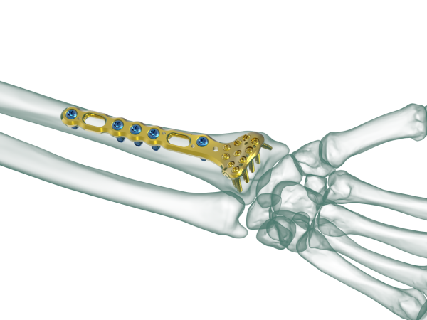 Distal Radius Anatomy