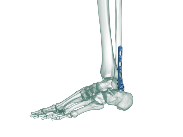 distal fibula